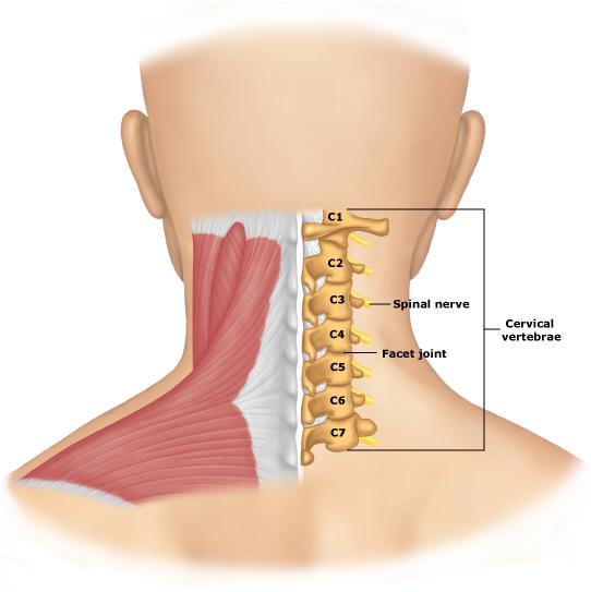 Herniated Disc In Neck. Herniated disk neck